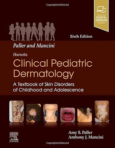 Mancini and Paller - Hurwitz Clinical Pediatric Dermatology