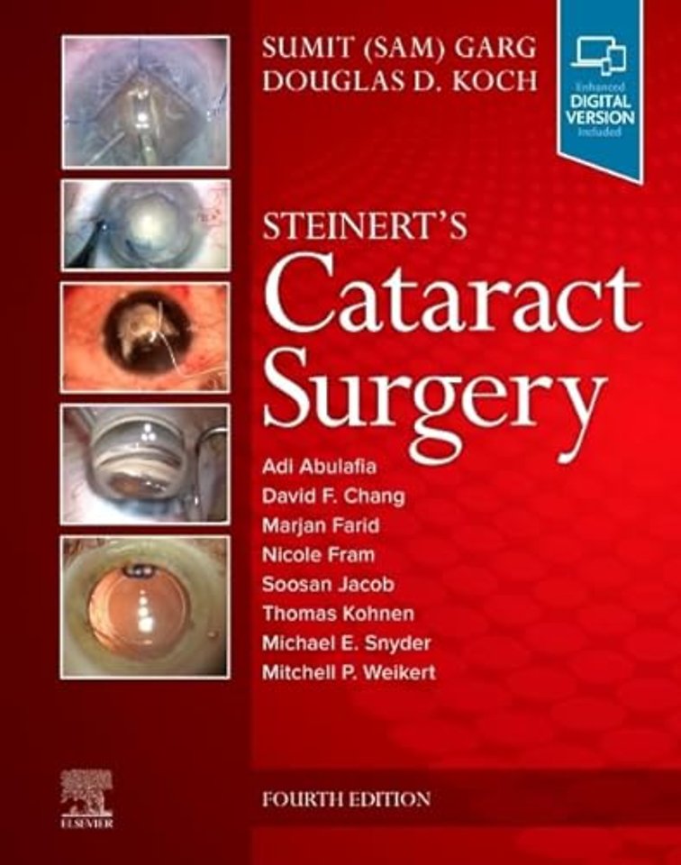 Steinert's Cataract Surgery