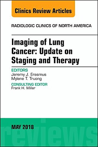Lung Cancer, An Issue of Radiologic Clinics of North America