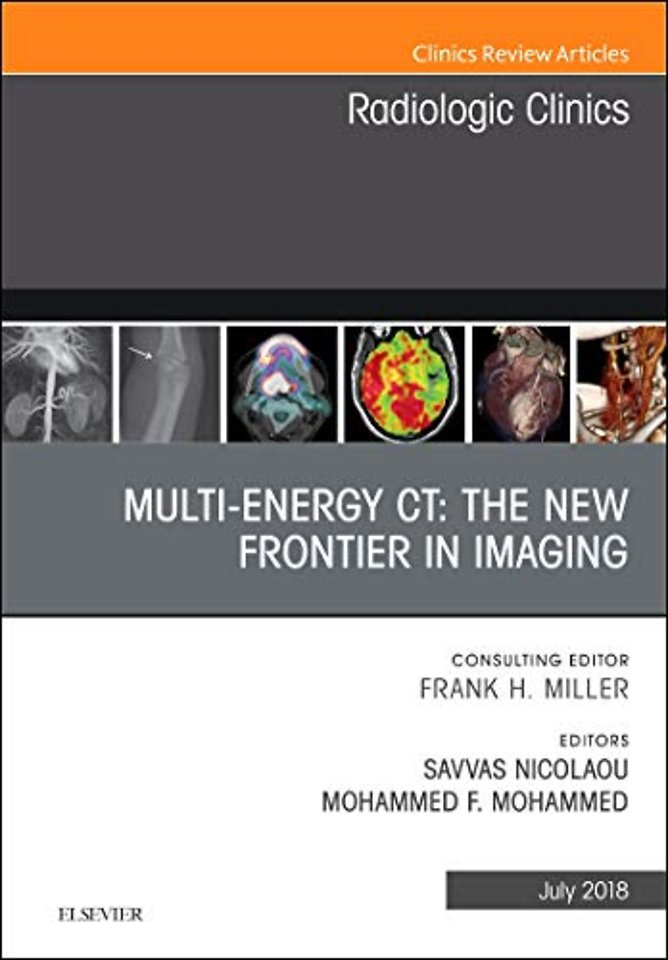 Multi-Energy CT: The New Frontier in Imaging, An Issue of Radiologic Clinics of North America