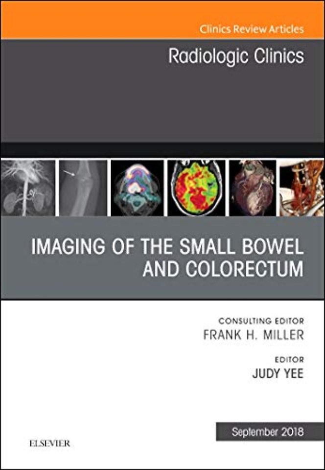 Imaging of the Small Bowel and Colorectum, An Issue of Radiologic Clinics of North America
