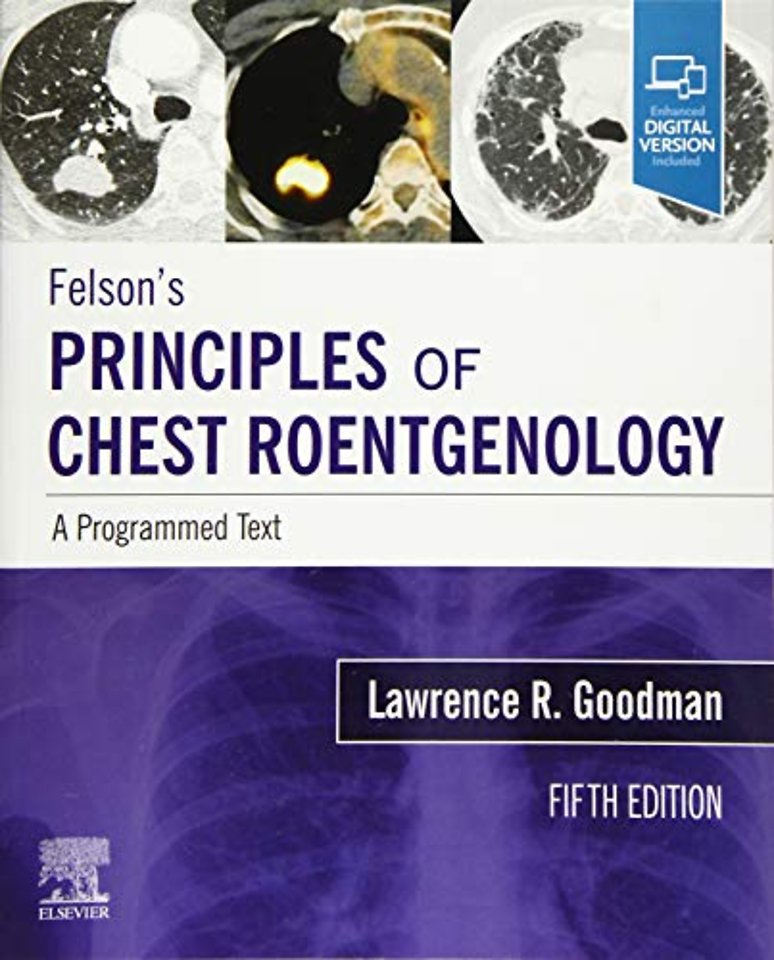 Felson's Principles of Chest Roentgenology, A Programmed Text