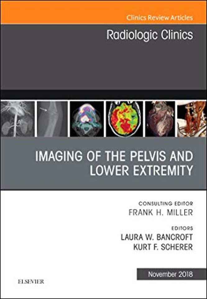 Imaging of the Pelvis and Lower Extremity, An Issue of Radiologic Clinics of North America