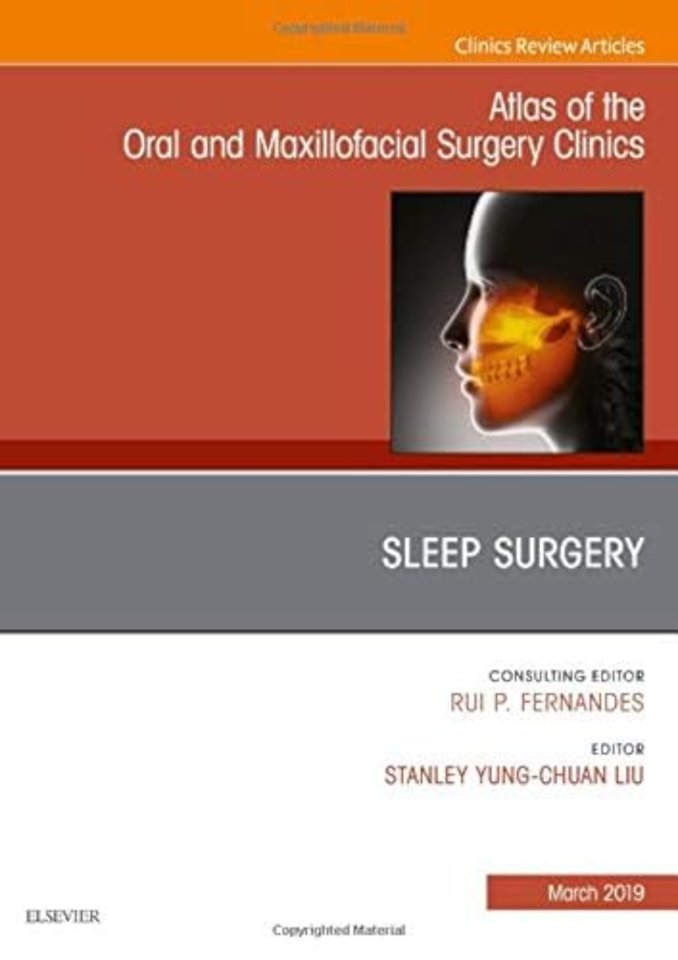 Sleep Surgery, An Issue of Atlas of the Oral & Maxillofacial Surgery Clinics