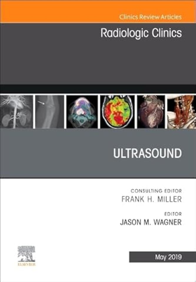 Ultrasound, An Issue of Radiologic Clinics of North America