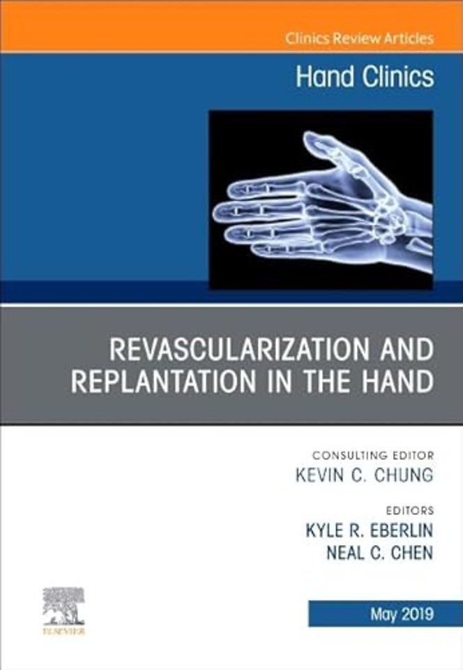 Revascularization and Replantation in the Hand, An Issue of Hand Clinics
