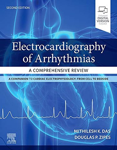 Electrocardiography of Arrhythmias: A Comprehensive Review