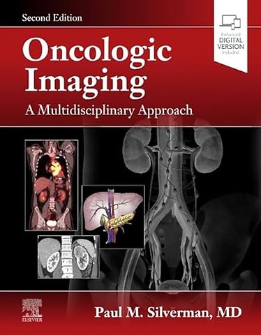 Oncologic Imaging: A Multidisciplinary Approach