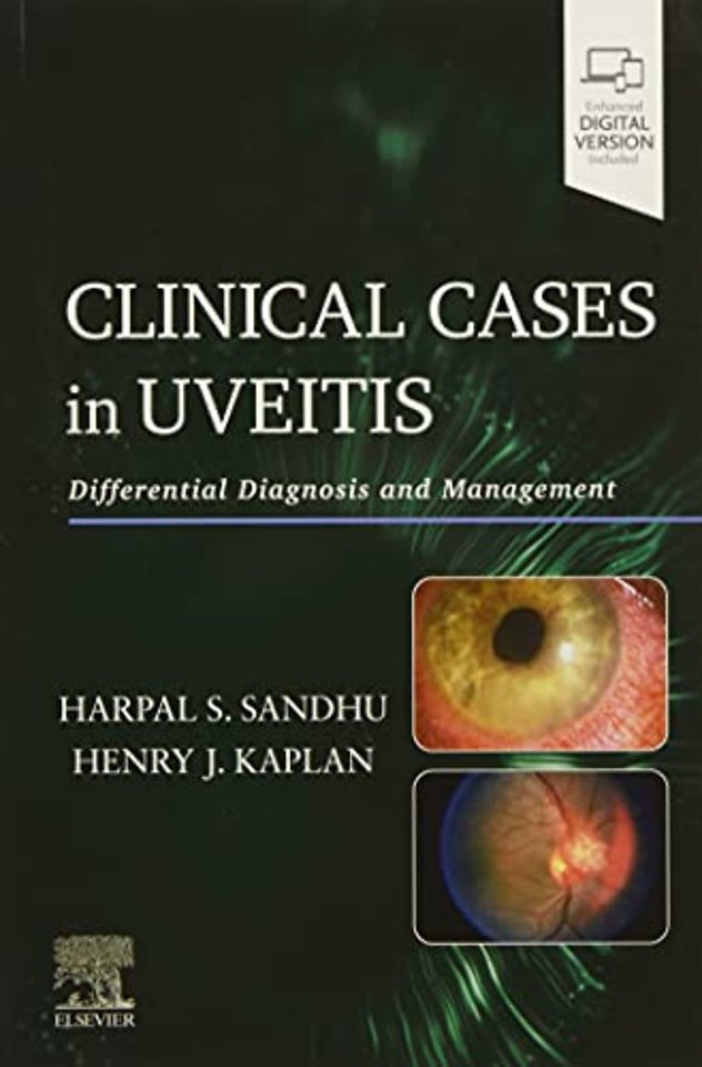 Clinical Cases in Uveitis