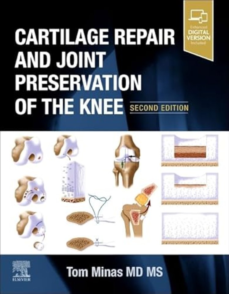 Cartilage Repair and Joint Preservation of the Knee