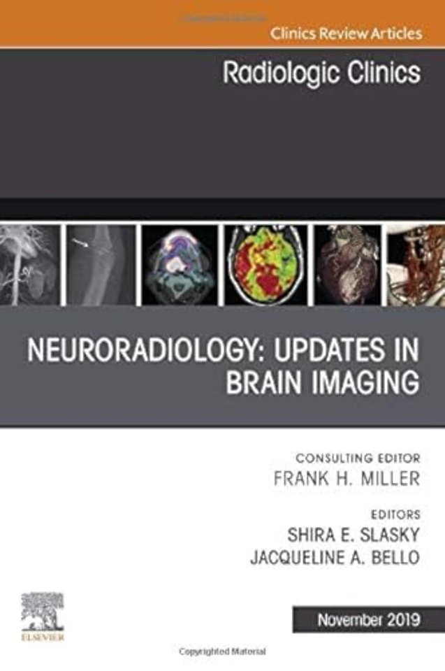 Neuroradiology, An Issue of Radiologic Clinics of North America