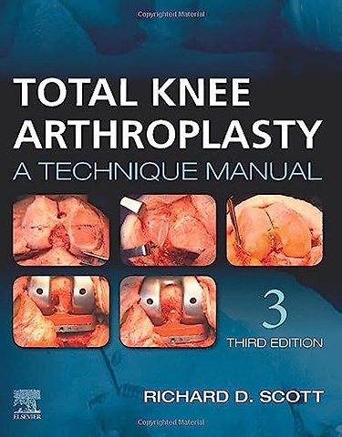 Total Knee Arthroplasty