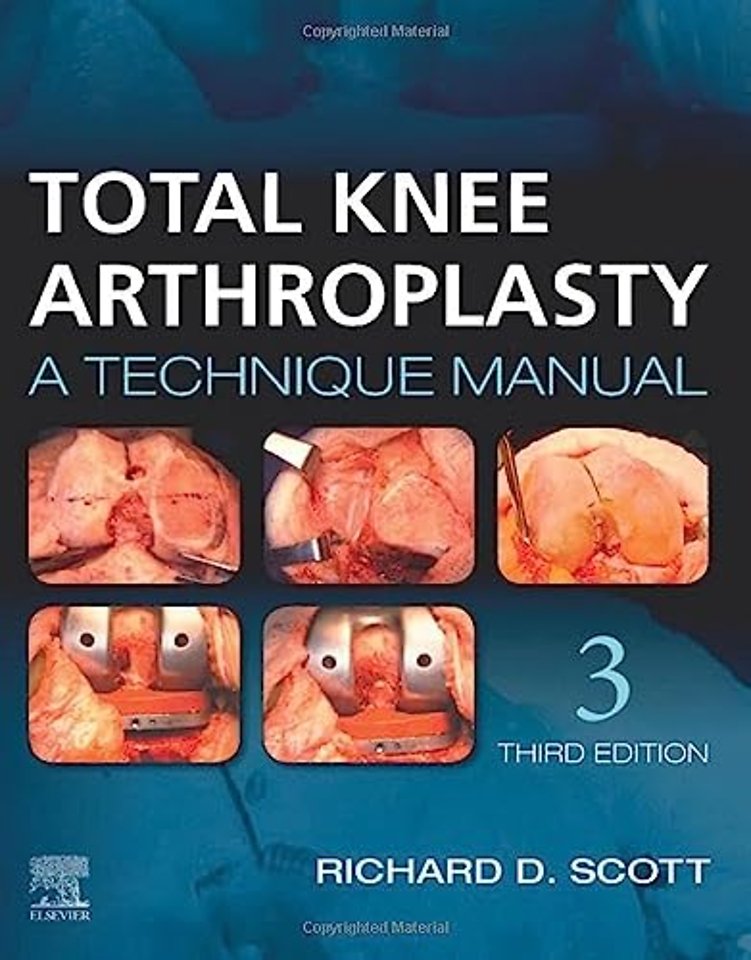 Total Knee Arthroplasty