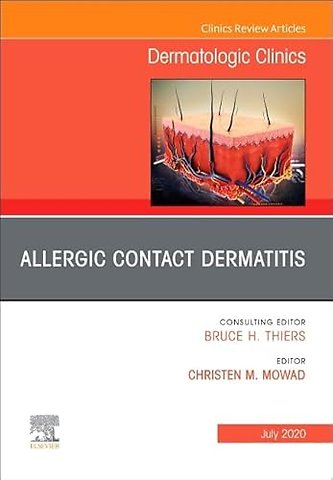 Allergic Contact Dermatitis, An Issue of Dermatologic Clinics
