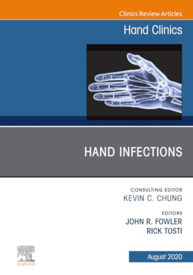 Hand Infections, An Issue of Hand Clinics