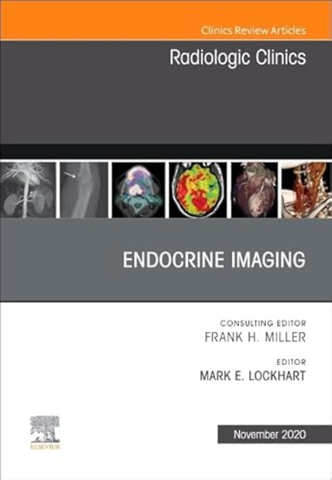 Endocrine Imaging, An Issue of Radiologic Clinics of North America