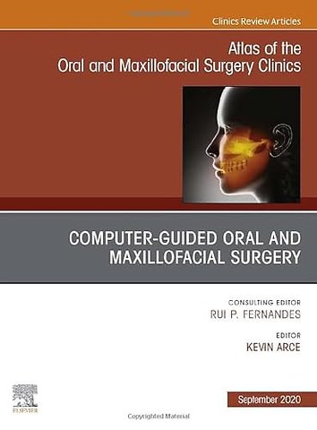 Guided Oral and Maxillofacial Surgery, An Issue of Atlas of the Oral & Maxillofacial Surgery Clinics