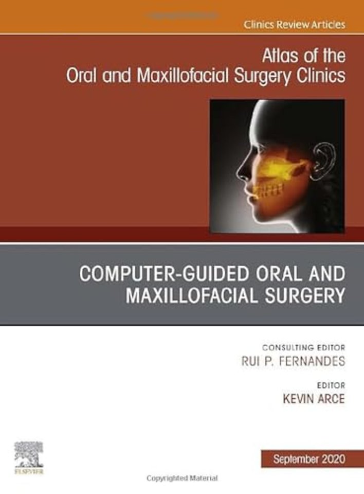 Guided Oral and Maxillofacial Surgery, An Issue of Atlas of the Oral & Maxillofacial Surgery Clinics
