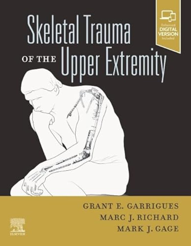 Skeletal Trauma of the Upper Extremity