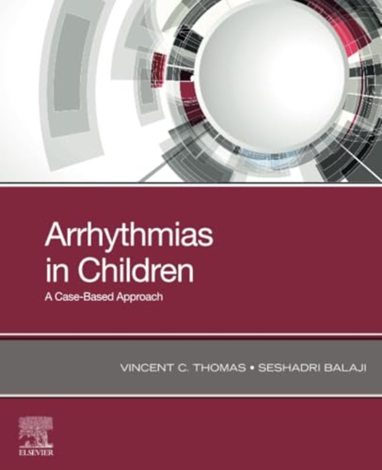 Arrhythmias in Children