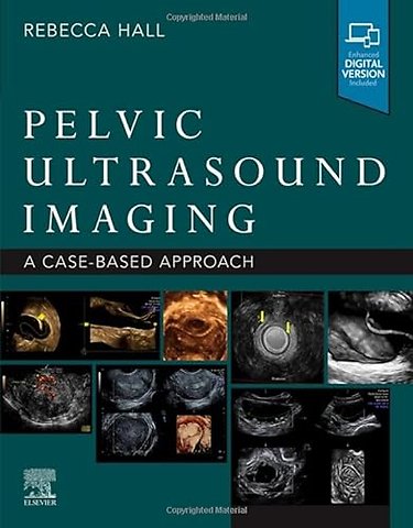 Pelvic Ultrasound Imaging