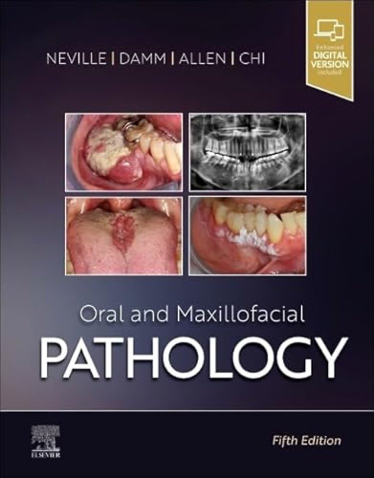 Oral and Maxillofacial Pathology