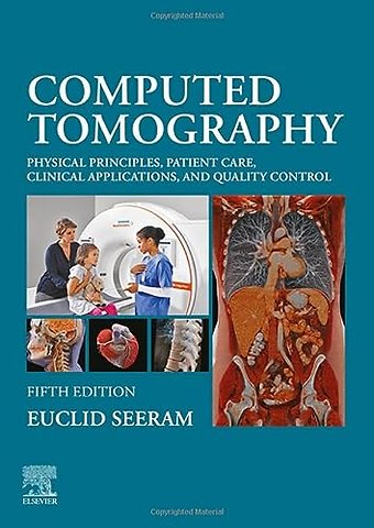 Computed Tomography