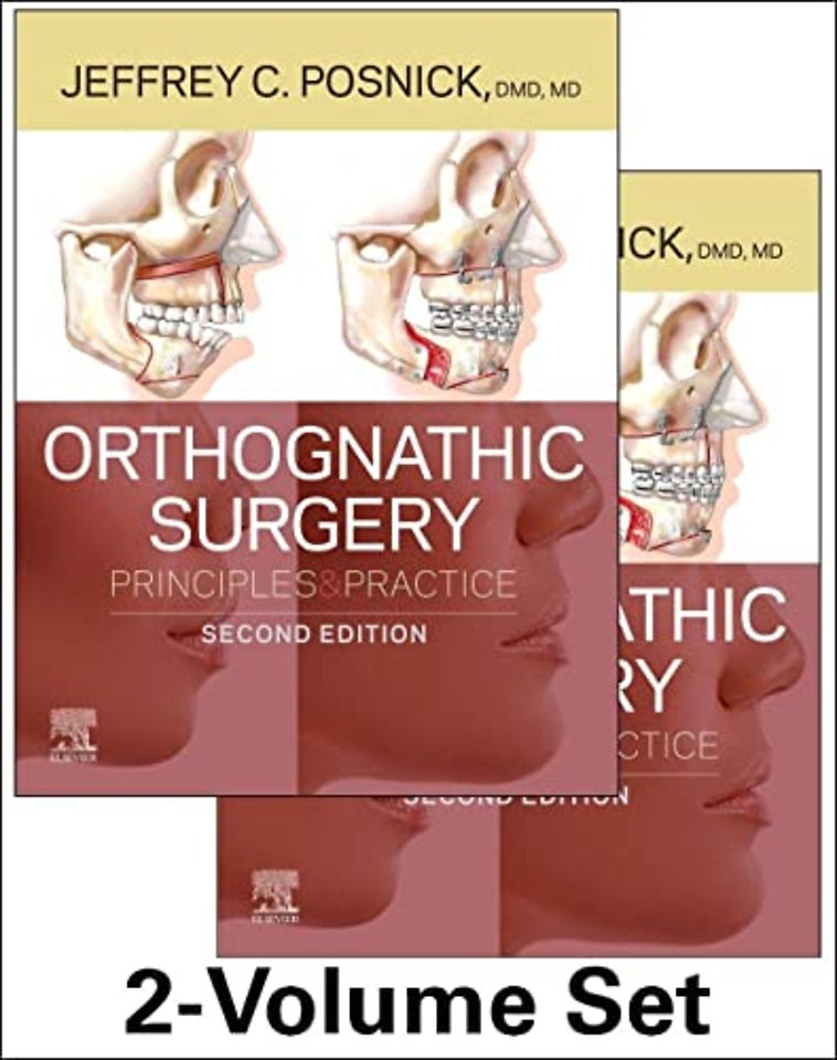 Orthognathic Surgery - 2 Volume Set