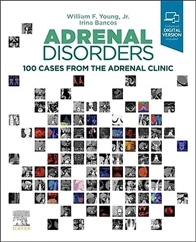 Adrenal Disorders