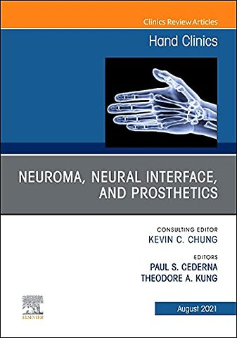 Neuroma, Neural Interface, and Prosthetics, An Issue of Hand Clinics