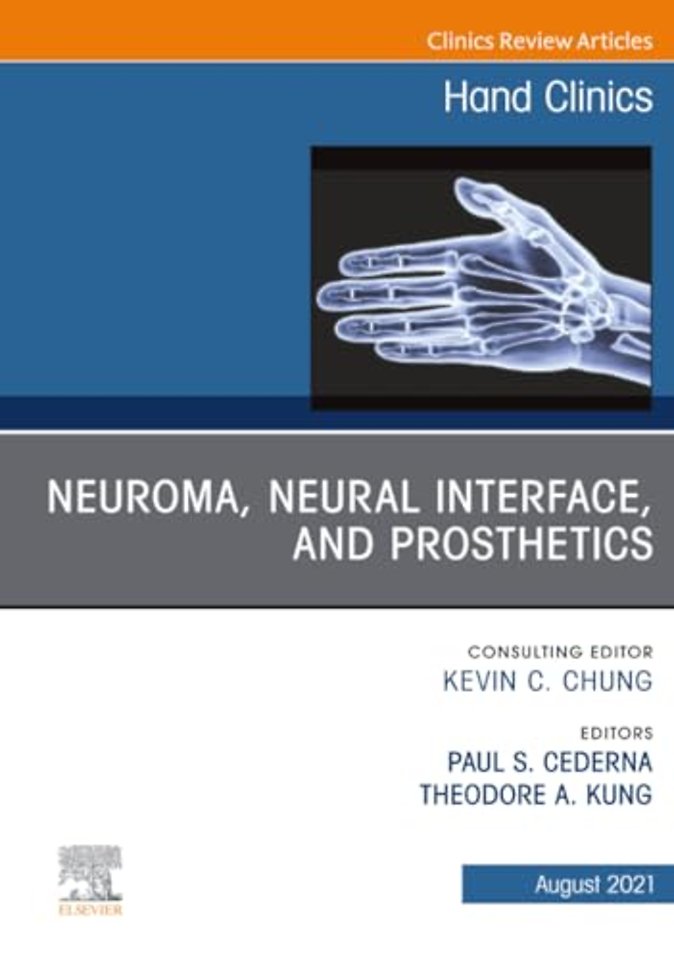 Neuroma, Neural Interface, and Prosthetics, An Issue of Hand Clinics