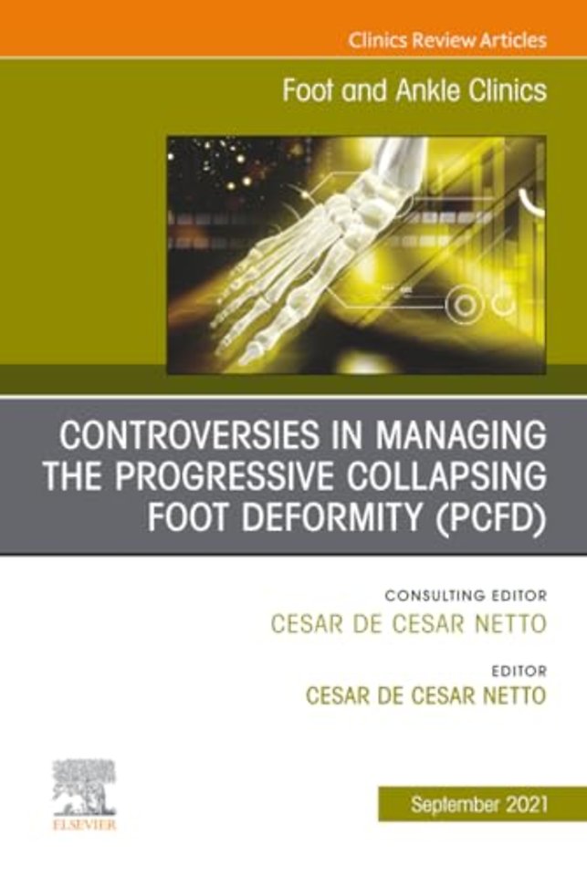 Controversies in Managing the Progressive Collapsing Foot Deformity (PCFD), An issue of Foot and Ankle Clinics of North America
