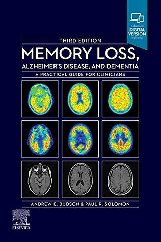 Memory Loss, Alzheimer's Disease and Dementia