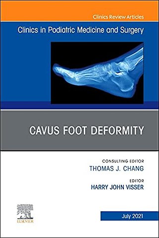 Cavus Foot Deformity, An Issue of Clinics in Podiatric Medicine and Surgery
