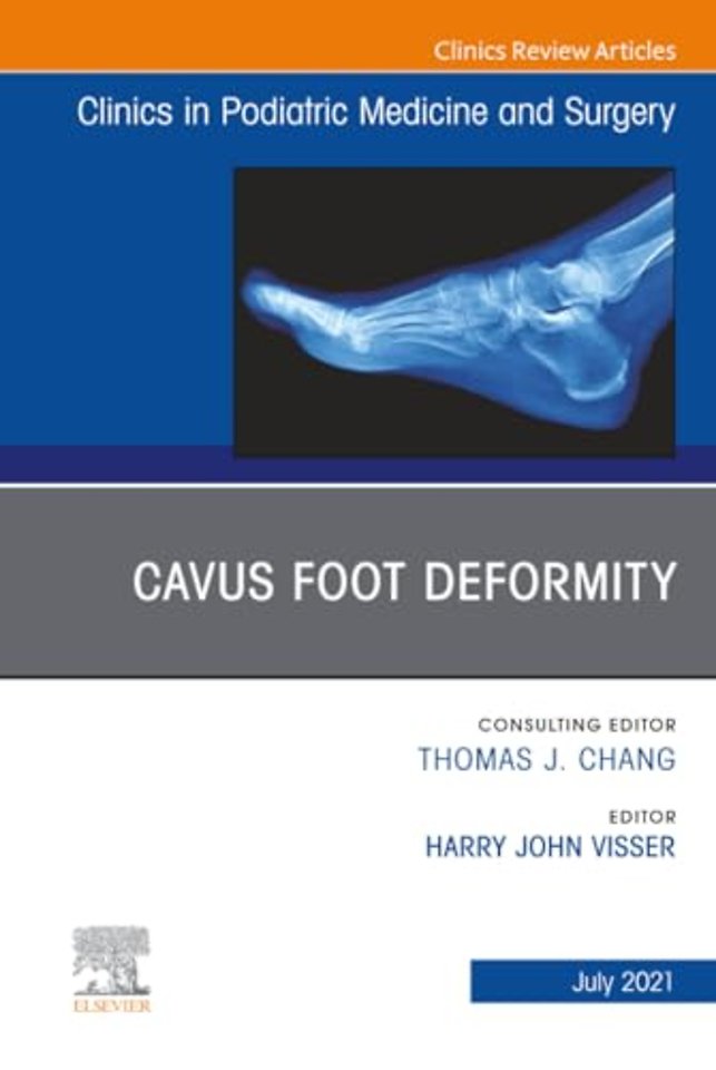 Cavus Foot Deformity, An Issue of Clinics in Podiatric Medicine and Surgery