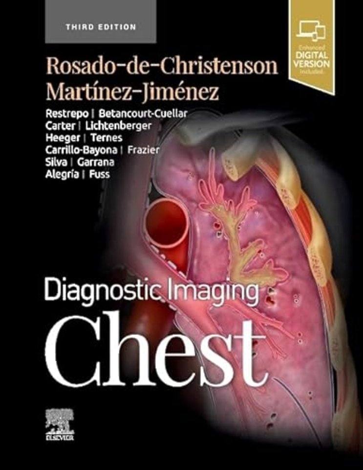 Diagnostic Imaging: Chest