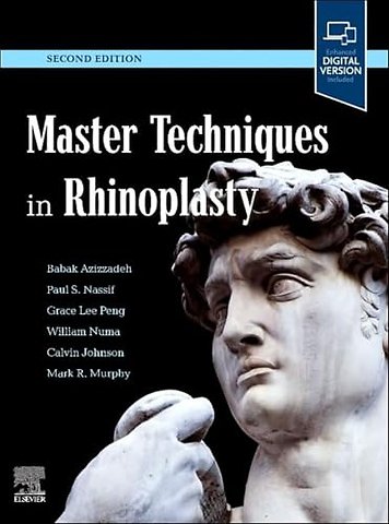 Master Techniques in Rhinoplasty