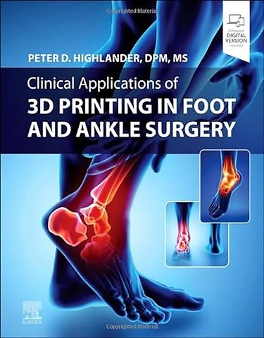 Clinical Applications of 3D Printing in Foot and Ankle Surgery