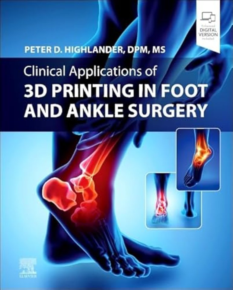 Clinical Applications of 3D Printing in Foot and Ankle Surgery