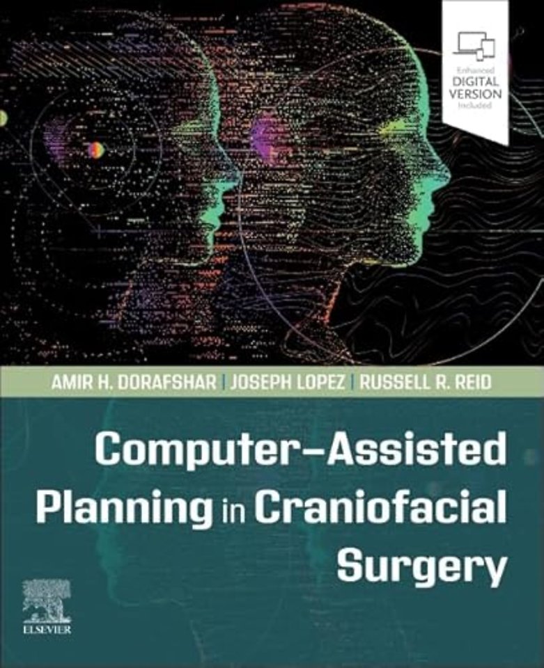 Computer-Assisted Planning in Craniofacial Surgery