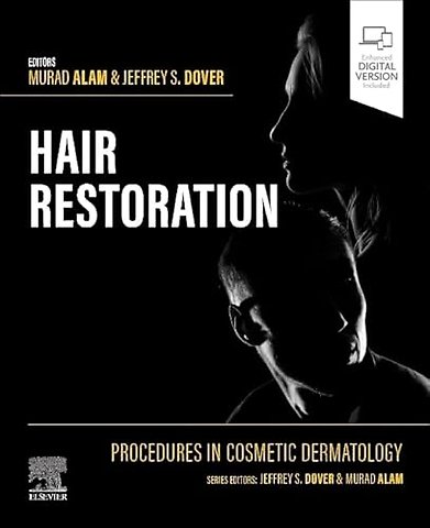 Procedures in Cosmetic Dermatology: Hair Restoration