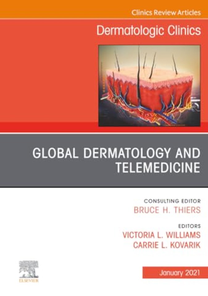 Global Dermatology and Telemedicine, An Issue of Dermatologic Clinics