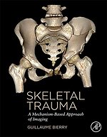 Skeletal Trauma
