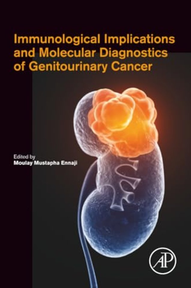 Immunological Implications and Molecular Diagnostics of Genitourinary Cancer