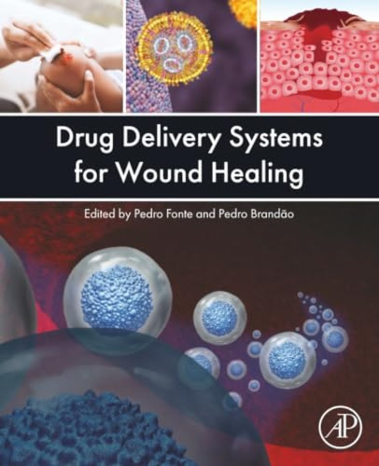Drug Delivery Systems for Wound Healing
