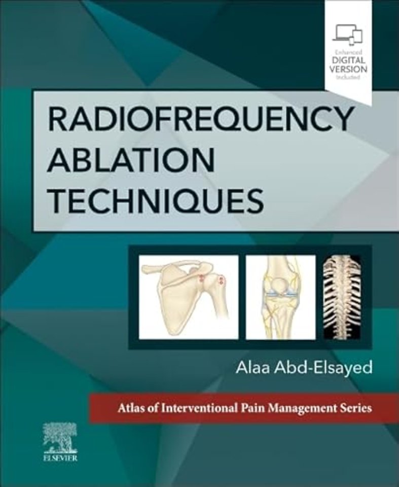 Radiofrequency Ablation Techniques