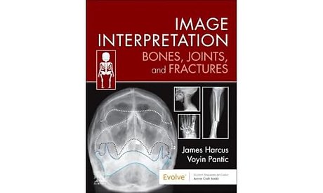 Image Interpretation: Bones, Joints, and Fractures