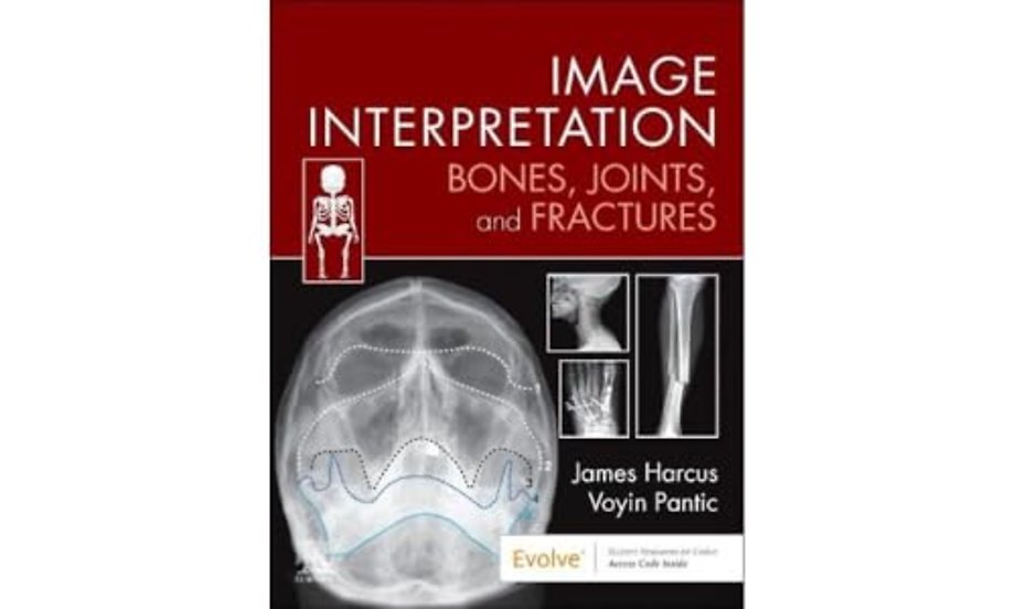Image Interpretation: Bones, Joints, and Fractures