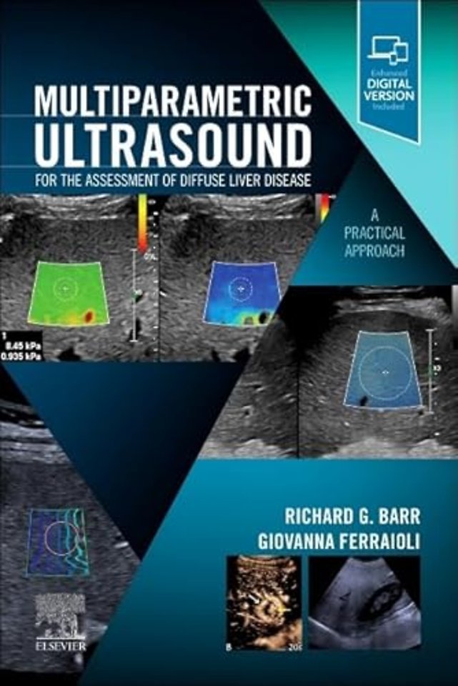 Multiparametric Ultrasound for the Assessment of Diffuse Liver Disease