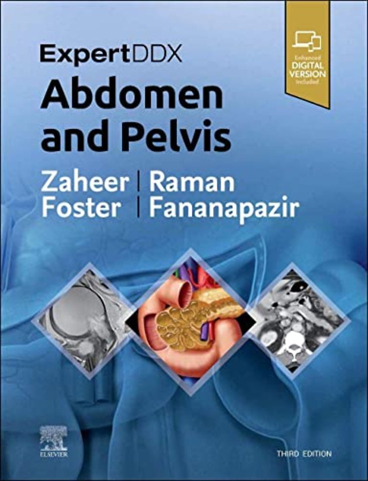 ExpertDDx: Abdomen and Pelvis